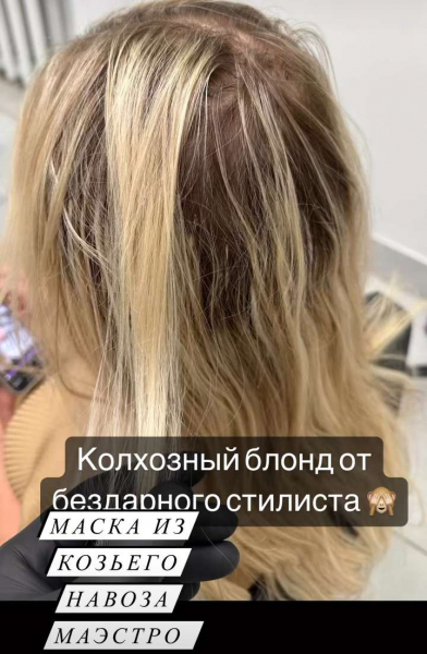 Дана Борисова чудом восстановила волосы после бьюти-процедуры с козьими экскрементами